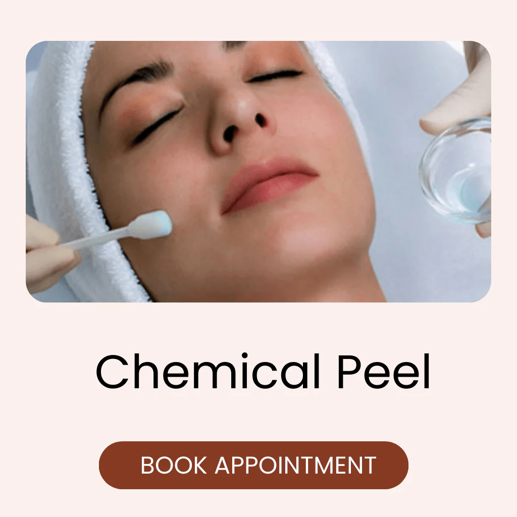chemical peel treatment in bangalore