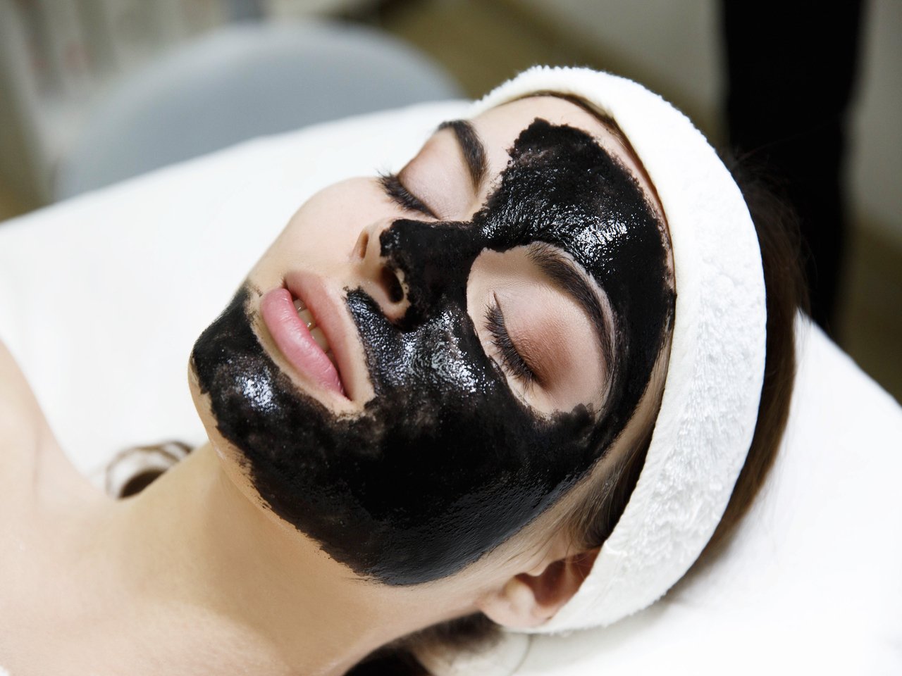 Young woman undergoing a carbon peel treatment to rejuvenate skin, reduce acne, and improve skin glow at a dermatology clinic.