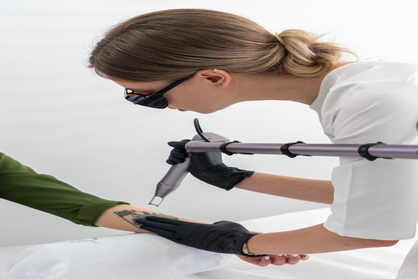 A professional technician wearing protective eyewear and black gloves performing laser tattoo removal on a client’s arm in a clinical setting.