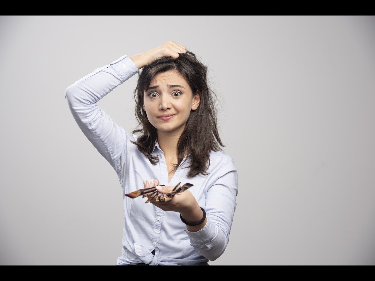 A frustrated young woman scratching her head with dandruff flakes visible, holding hair care products in her hand, emphasizing the need to rid of dandruff permanently.