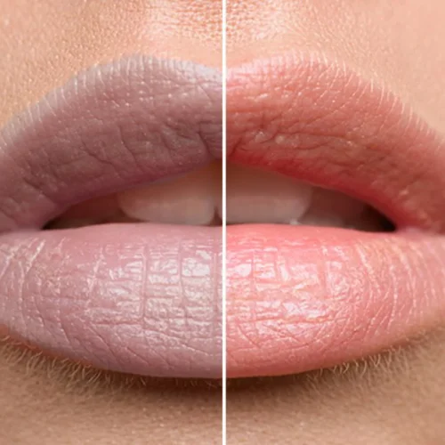 beautiful-lips-istock-1-2383743